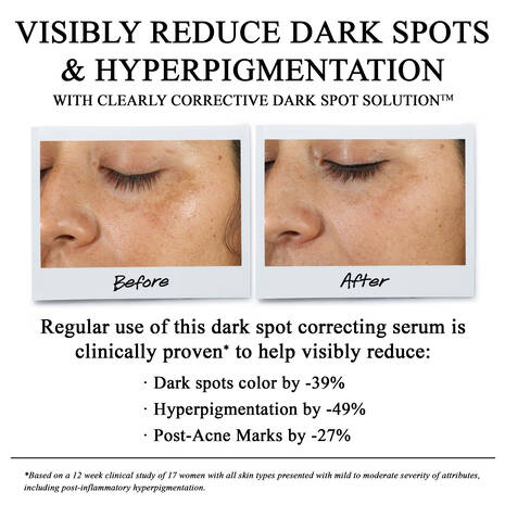حلاحة تصحيح البقع الداكنة Clearly Corrective™ من Kiehl's