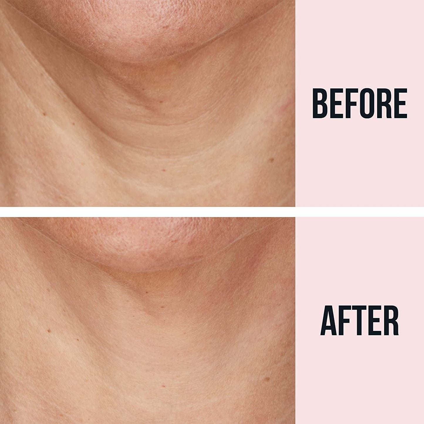 SiO Beauty NeckLift, 1 patch