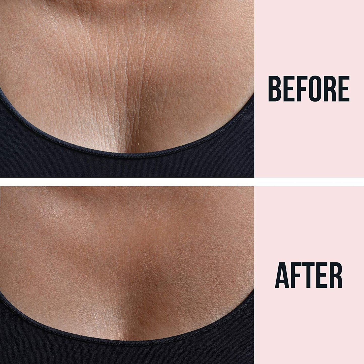 SiO Beauty Chest Lift, 1pk