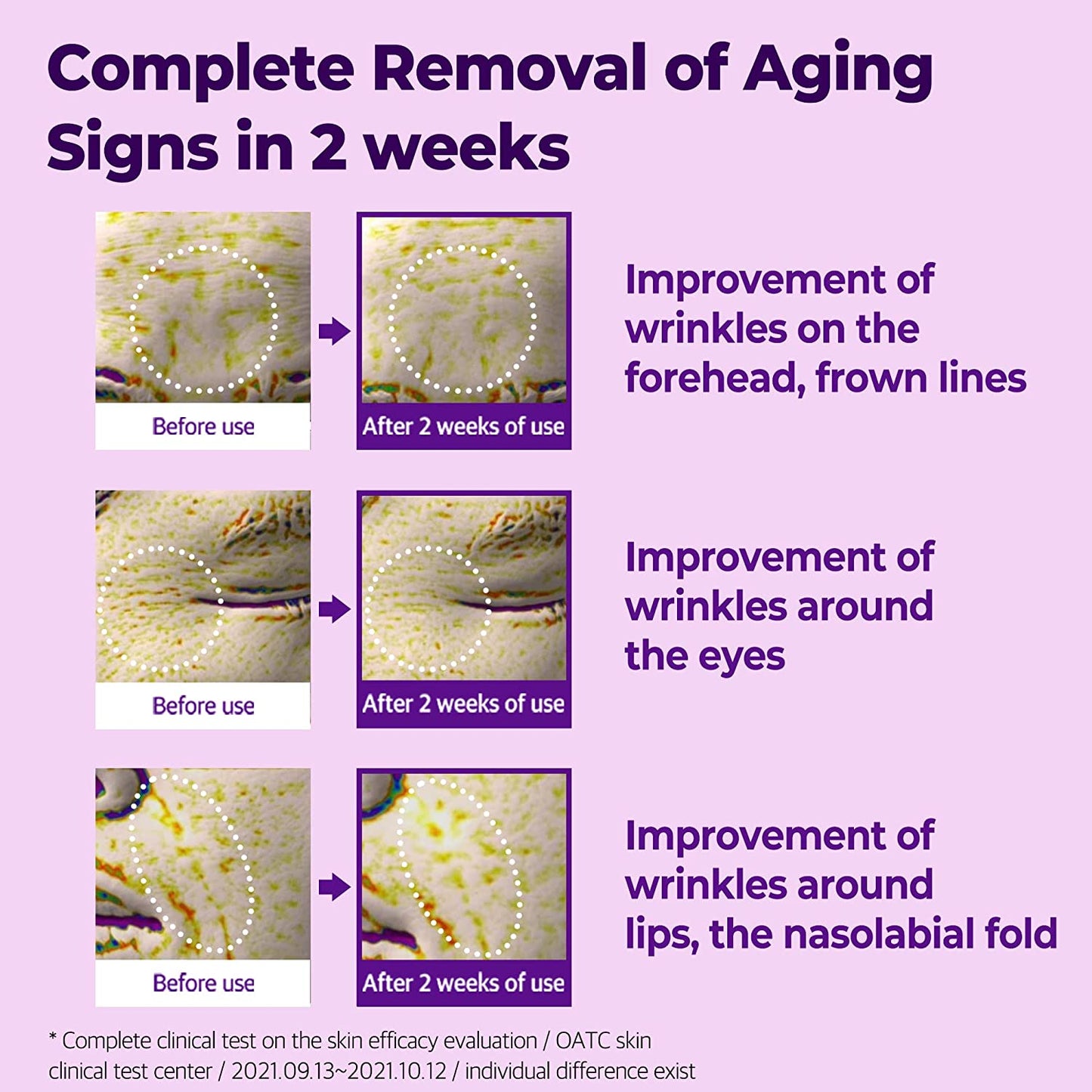 كريم العيون المتقدم SOME BY MI Retinol Intense للعمل المتعدد، 30 مل