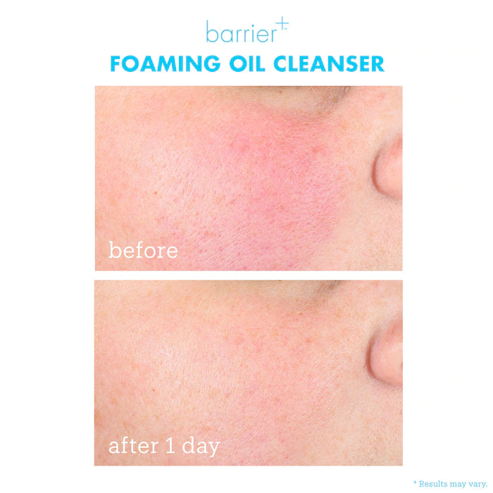 منظف الزيت الرغوي Barrier+ Foaming Oil Hydrating من Skinfix، 177 مل
