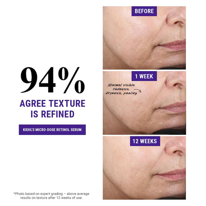 Kiehl's Since 1851 Micro-Dose Anti-Aging Retinol Serum Skin Renewing with Ceramides and Peptide، 30 مل