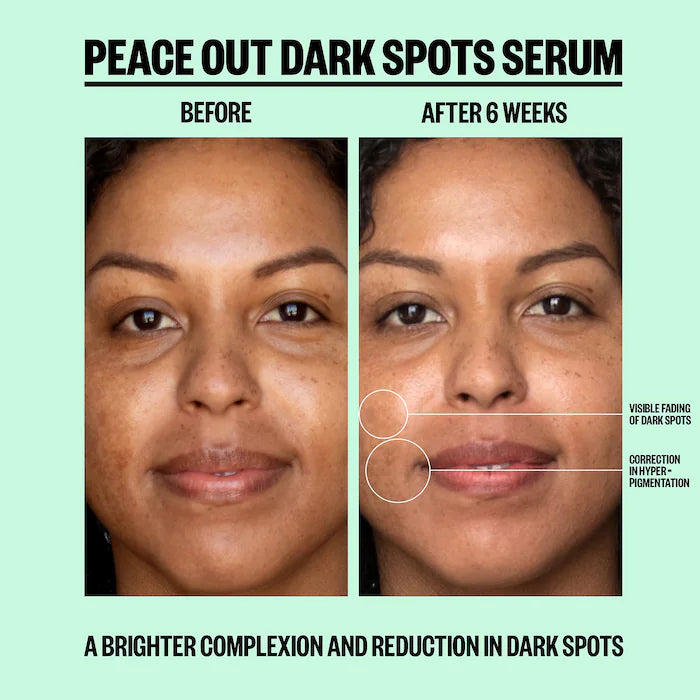 Peace Out Dark Spots Serum, 30 ml