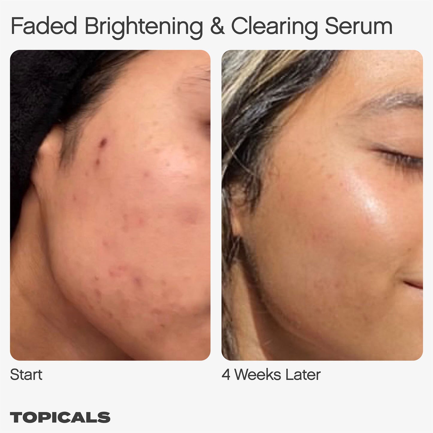سيروم Mini Faded للبقع الداكنة والاسمرار من توبيكالز، 15 مل، 50 مل