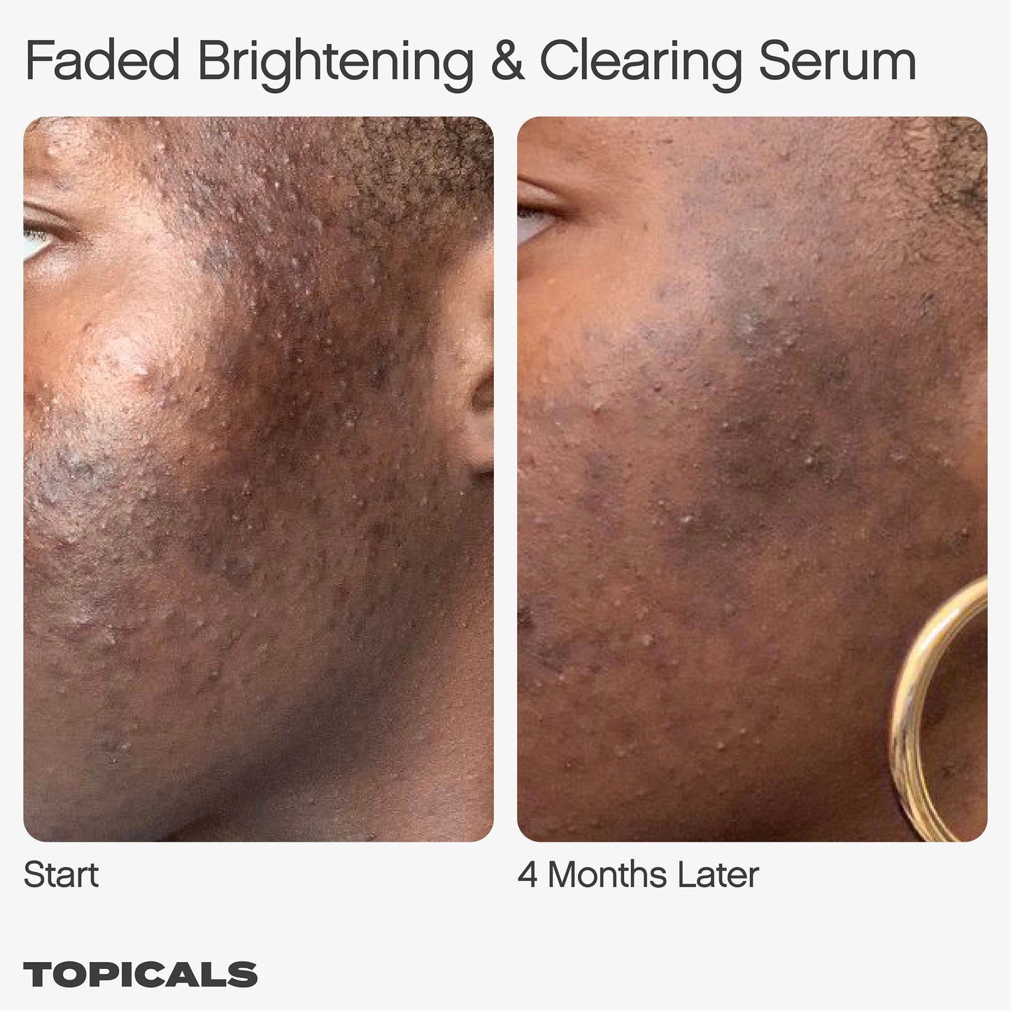 سيروم Mini Faded للبقع الداكنة والاسمرار من توبيكالز، 15 مل، 50 مل