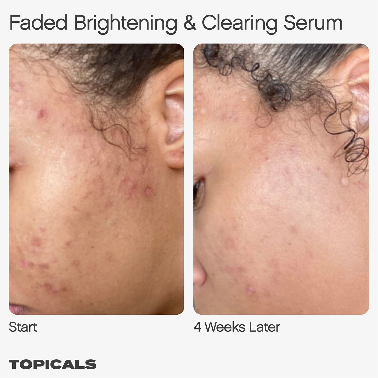 سيروم Mini Faded للبقع الداكنة والاسمرار من توبيكالز، 15 مل، 50 مل