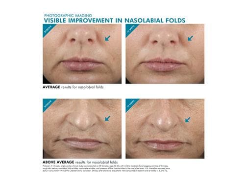 سيروم تصحيح البقع الداكنة H.A Intensifier من Correct Skin Ceuticals، 30 مل