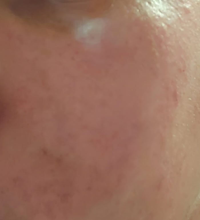 Saved My Skin