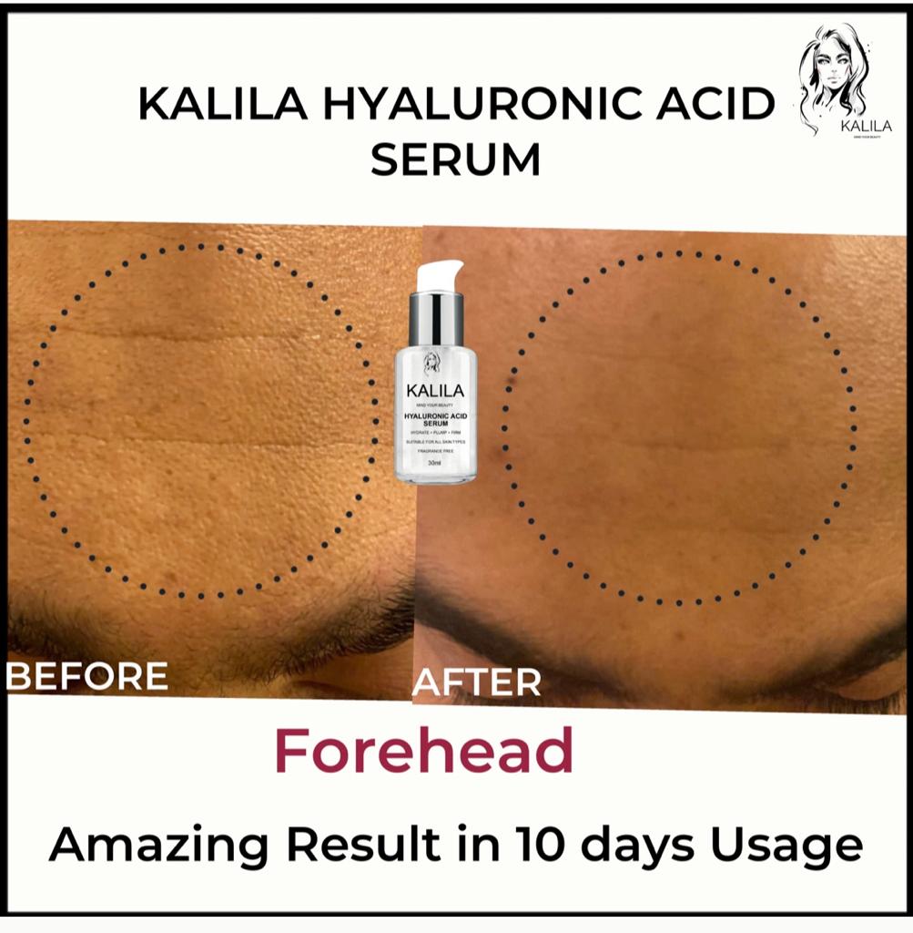 KALILA Hyaluronic Acid Serum, 30ml + 6ml Free
