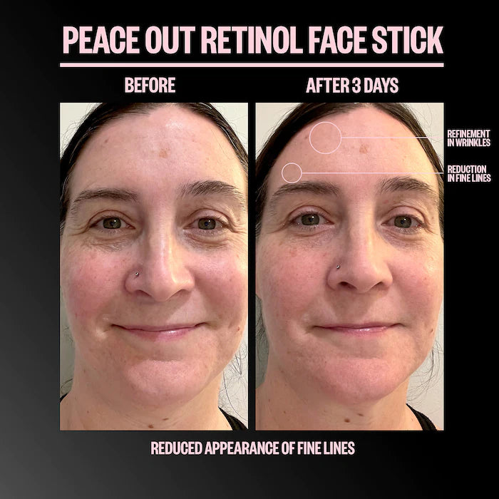 Peace Out Retinol Face Stick, 8 g
