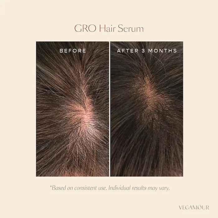 Vegamour GRO Hair Serum for Thinning Hair, 30 ml